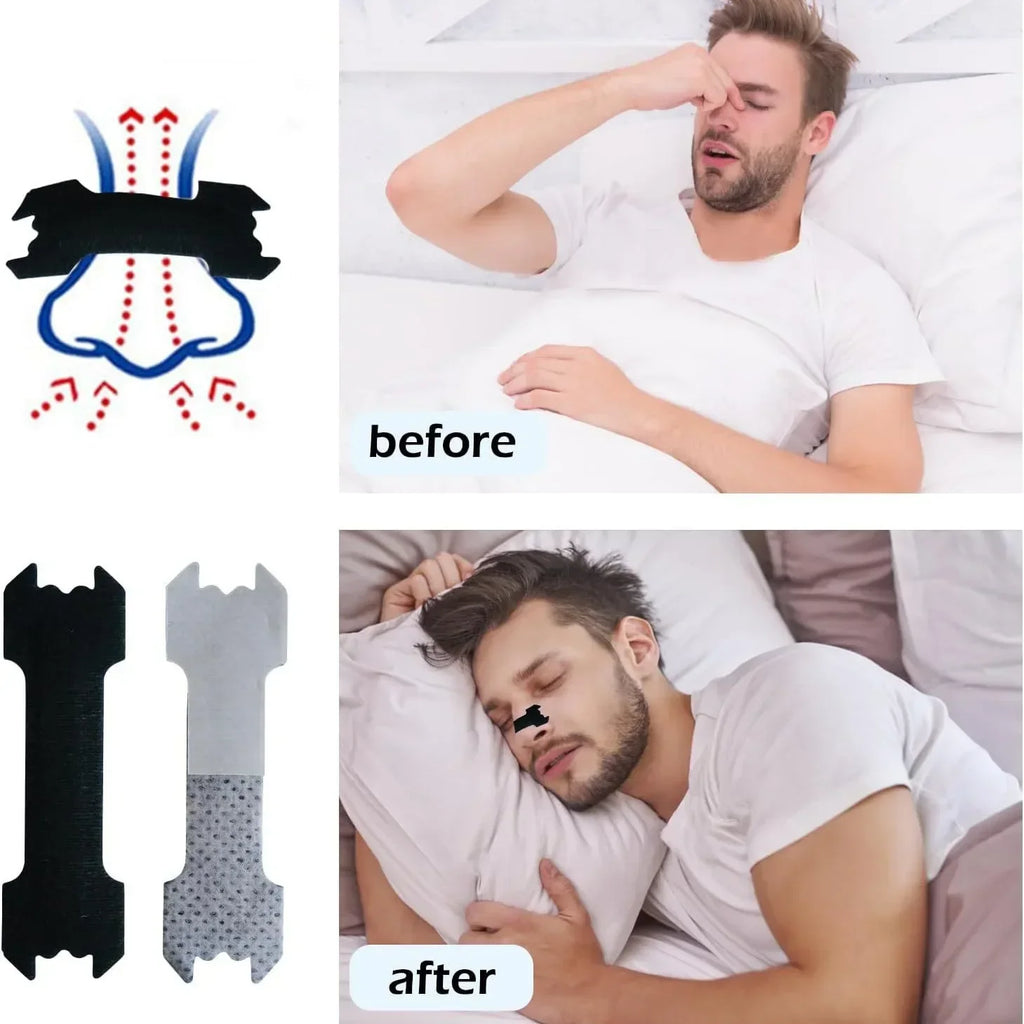 Sports Nasal Strips — Anti-Snoring Sleep Aid (30/90/150 Pack)